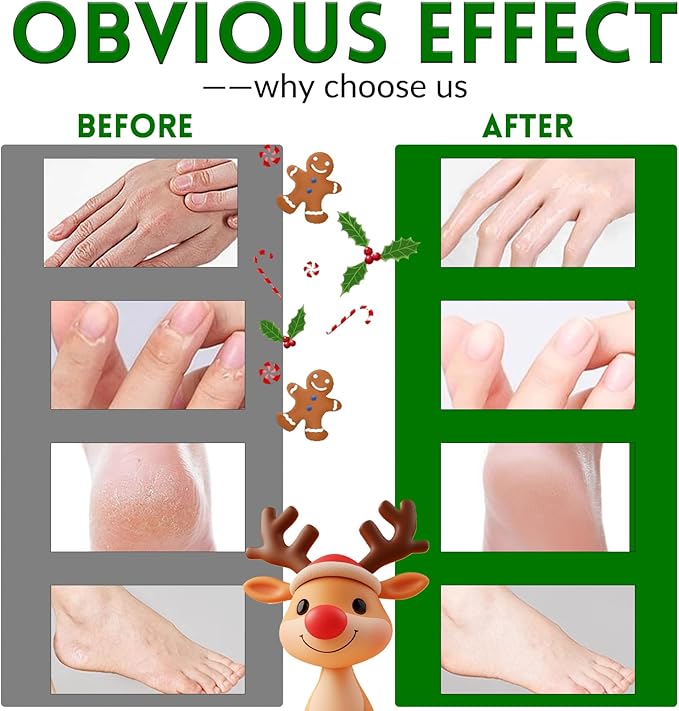 Foot Mask Hand Mask Christmas Gifts Hydrating Moisturizing 12 Packs Gloves & Socks Intensive Repairing Masks Peeling Mask for Women Dry Cracked Set Coconut Oil Tea Tree Extract Elitzia ETXJ2409