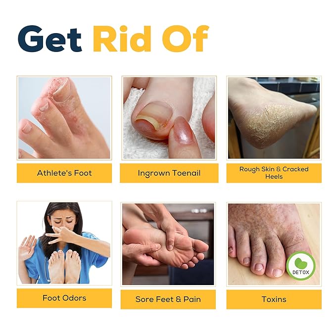 FOOT CURE Tea Tree & Citrus Foot Soak with Epsom Salt – Supports Tired Feet, Softens Calluses, and Refreshes (Pack of 2)