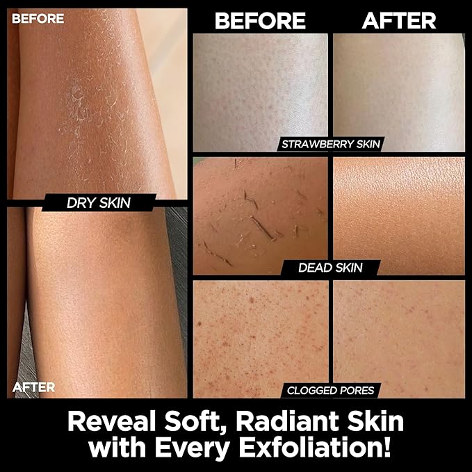 Exfoliating Glove Kessa Mitt Body Scrubber - Dead Skin Remover Shower Glove for Dead Skin Scrubbing and Deep Pore Cleansing - by MoroccanSource (3 Piece spa Set)