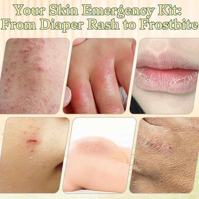 Beef Tallow for Skin with Raw Honey - Multi-Purpose Moisturizer & Repair Cream for Dry, Sensitive Skin - All-Natural, Non-Greasy, Unscented Formula with Beeswax & Olive Oil for Face & Body 4oz