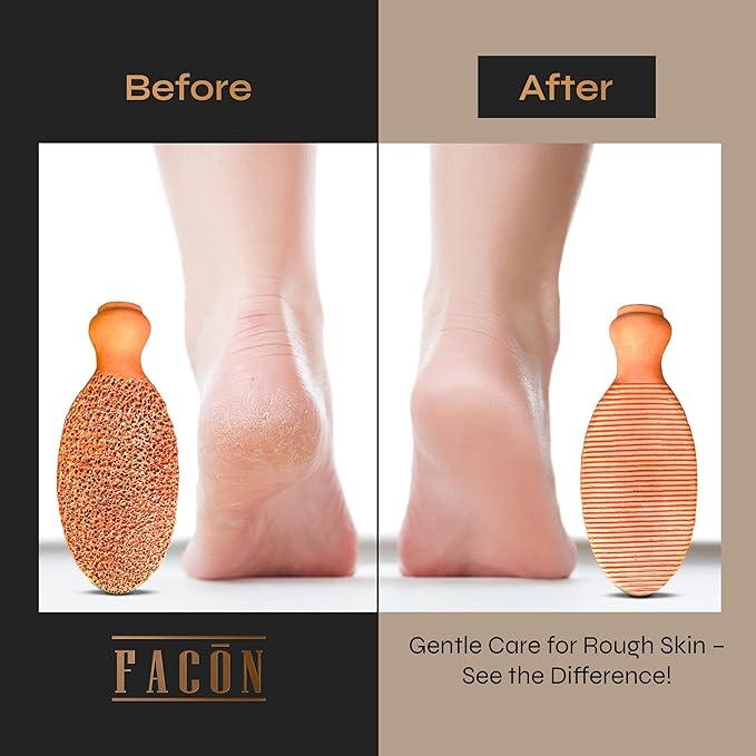 Facón Pumice Stone for Feet Callus Remover - Terra-Cotta Foot Scrubber with 2 Sides, 100% Pure Natural Foot Pumice Stone, Pedicure Pumice Stone Scrubber, Foot Exfoliator, Removes Calluses & Dead Skin