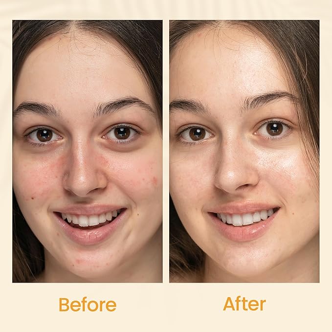 Honeyskin Gel Moisturizer for face – Lightweight Water Gel Infused with Coconut water with Niacinamide & Peptides for Deep Hydration – Hypoallergenic Face Moisturizer for Women 2oz