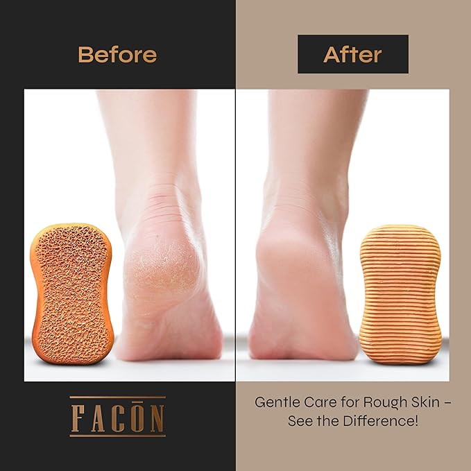 Facón Pumice Stone for Feet Callus Remover - Terra-Cotta Foot Scrubber with 2 Sides, 100% Pure Natural Foot Pumice Stone, Pedicure Pumice Stone Scrubber, Foot Exfoliator, Removes Calluses & Dead Skin