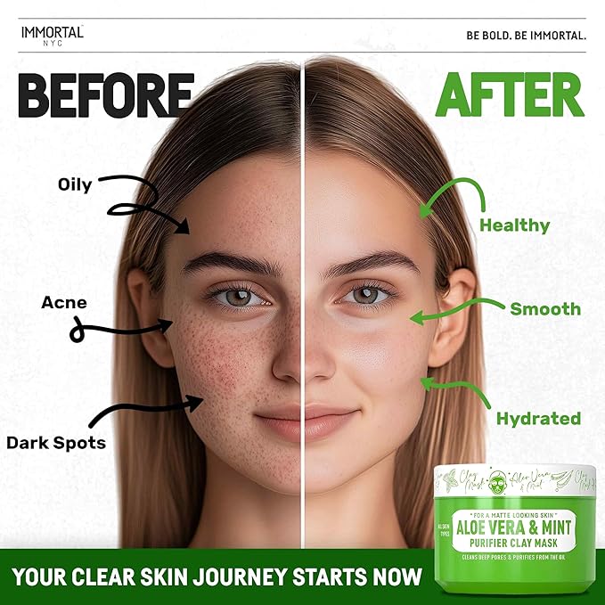 Immortal NYC Aloe Vera & Mint Purifier Clay Mask – Face Mask for Matte Look Skin, Oil Control, Deep Cleansing & Refreshing Skincare. Great Gifts For Women & Men – 10 oz