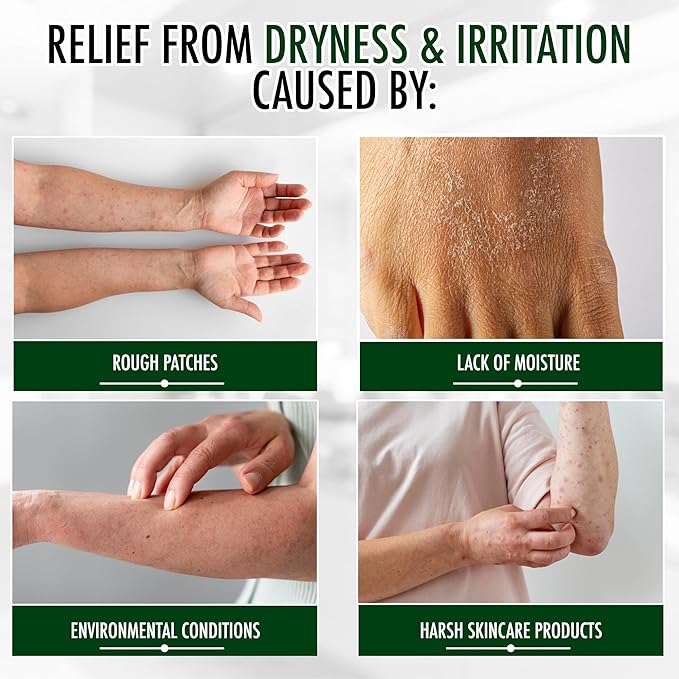 GLY MIRACLE Moisturizing Body Cream Lotion, 16 ounce - Non-Greasy Skin Humectant for Extremely Dry Skin, Hands, Body, and Feet, Fragrance-Free with Pure Glycerin for Nourishing Hydration.