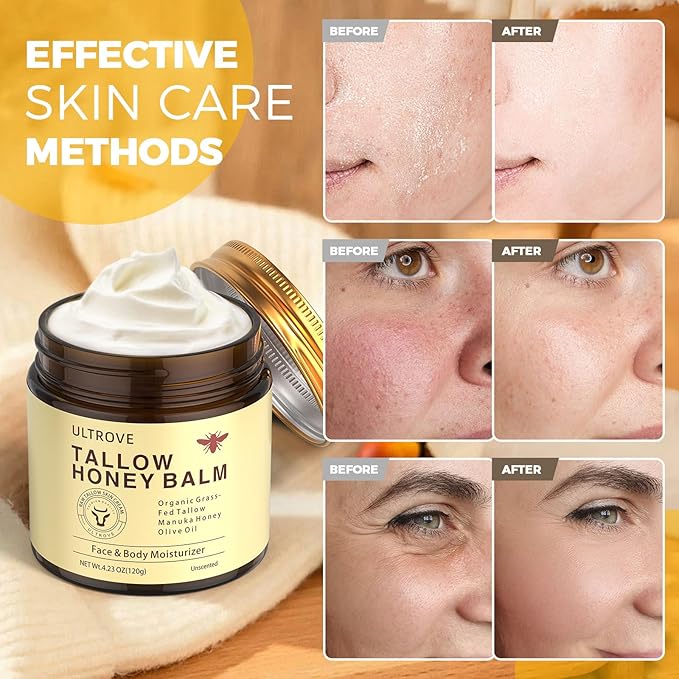 Beef Tallow and Honey Balm for Skin, Natural Face + Body Moisturizer with Organic Grass-Fed Beef Tallow & Raw Wild Honey for Dry & Sensitive Skin, 4.23oz