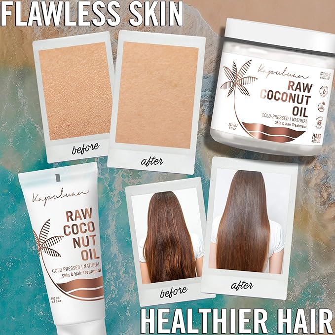 Coconut Oil for Skin & Hair – Organic, Cold Pressed, Extra Virgin & Unrefined | Natural Moisturizer & Hair Growth | 3 Pack (100ml)