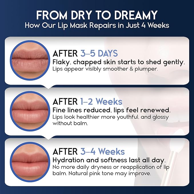 Lip Mask Overnight with Hyaluronic Acid & Collagen, Lip Sleeping Mask for Dry Cracked Lips, Moisturizing, Hydrating, Exfoliating Night Treatment for Lip Care (Strawberry) (0.7, Berry)